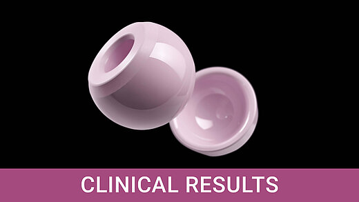 Pink BIOLOX delta ceramic femoral head and acetabular liner on black background, labelled Clinical Results.