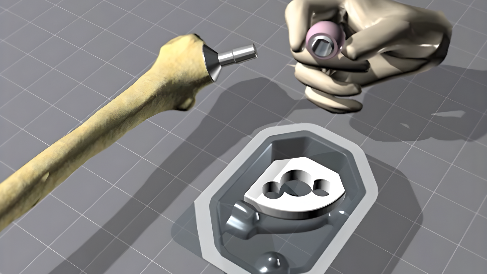 BIOLOX® Ceramic Head Placement in Total Hip Arthroplasty